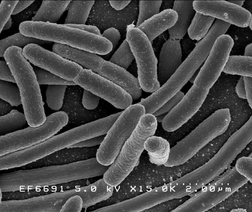 Study provides fresh insights into antibiotic resistance, fitness landscapes