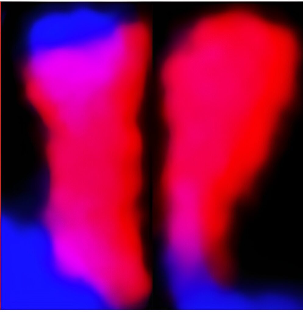 New research reveals major difference in genomes of American and Chinese chestnut