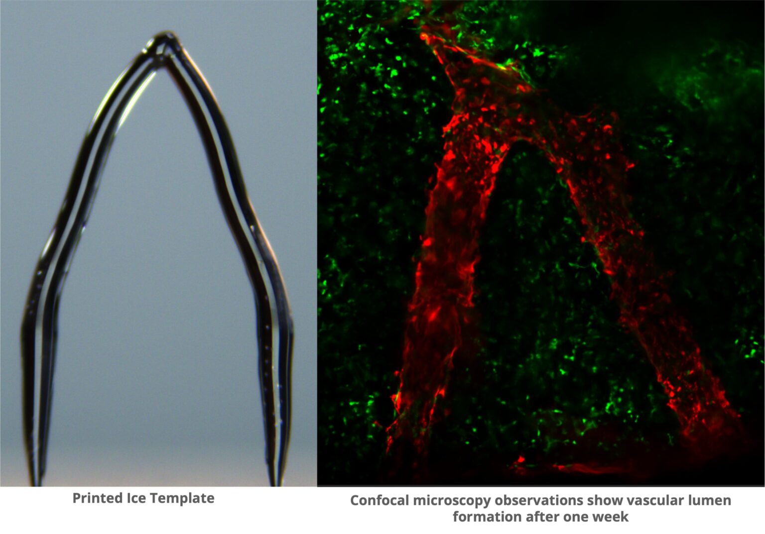 New 3D printing method uses ice to build a template for artificial blood vessels in engineered tissue