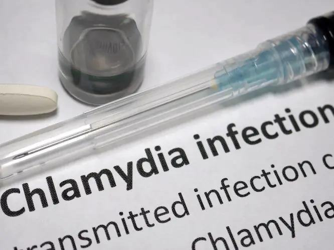 The Signs and Symptoms of Chlamydia: What To Do