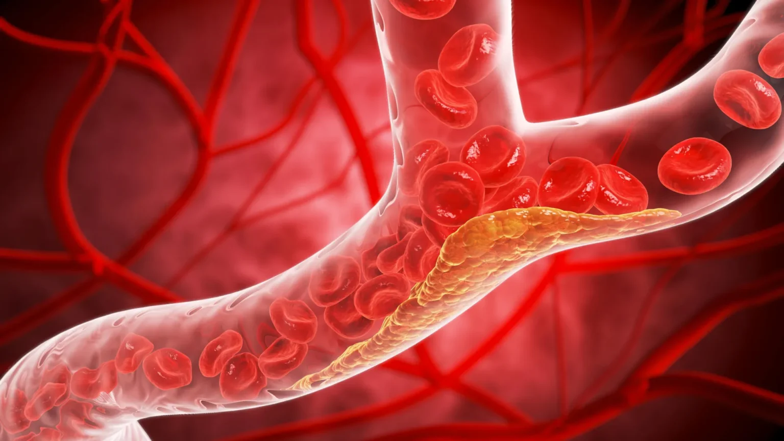 How type 2 diabetes quietly damages blood vessels