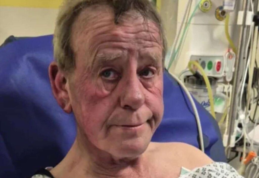 Dad suffers second-degree burns as candle sparks devastating house fire in Sidney Street, Folkestone