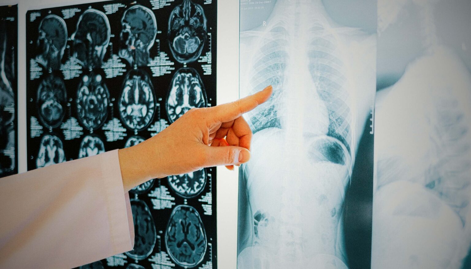 How AI Turned A Forgotten Organ Into Medicine’s Newest Longevity Metric
