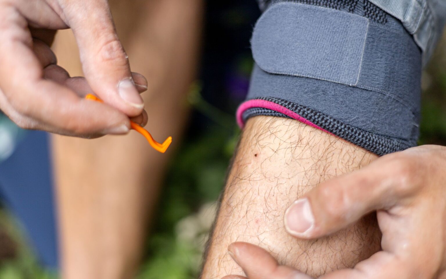 What is Lyme disease and how is it diagnosed and treated? – UK Health Security Agency